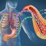 دیابت نوع 2 و نارسایی کلیه: رابطه ای پنهان اما خطرناک